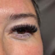 Volume 2 Week Fills (6 Months) at WinkCraft Aesthetics in Cleburne, TX