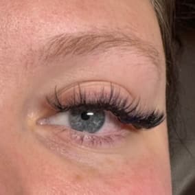 Volume 3 Week Fills (6 Month) at WinkCraft Aesthetics in Cleburne, TX